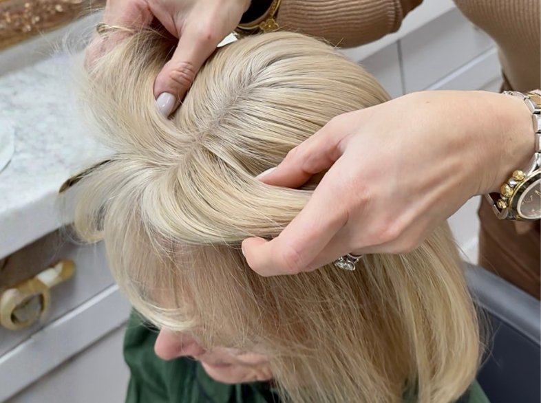 Classic hair topper for partial hair loss