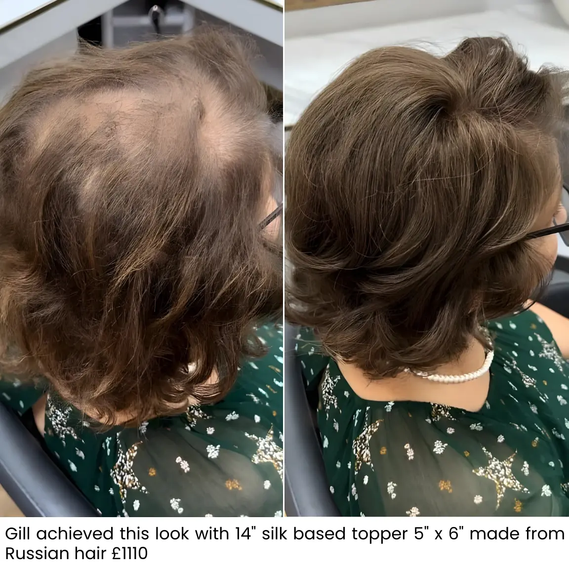 Gill, before and after hair topper