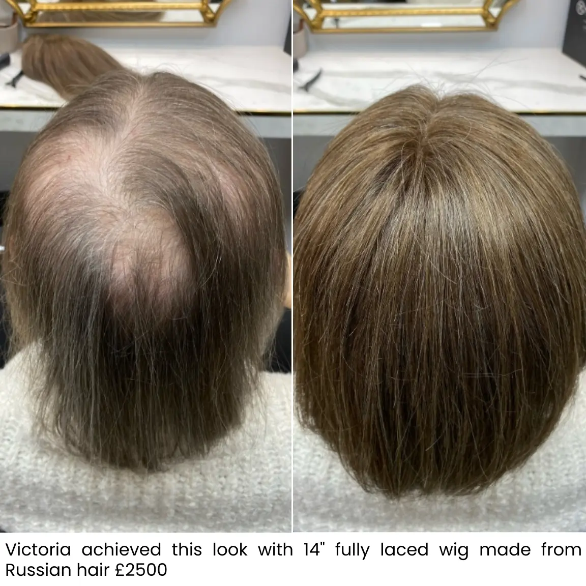 Victoria, before and after medical wig