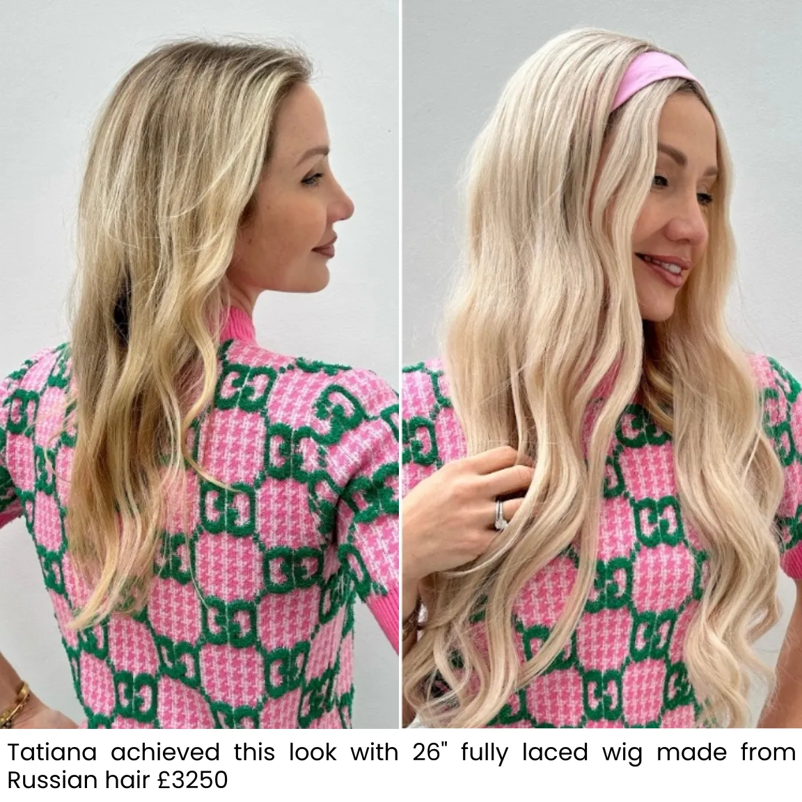 Tatiana, before and after medical wig