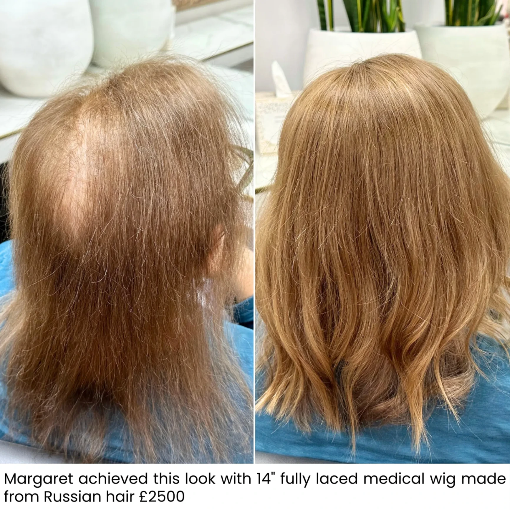 Margaret, before and after medical wig