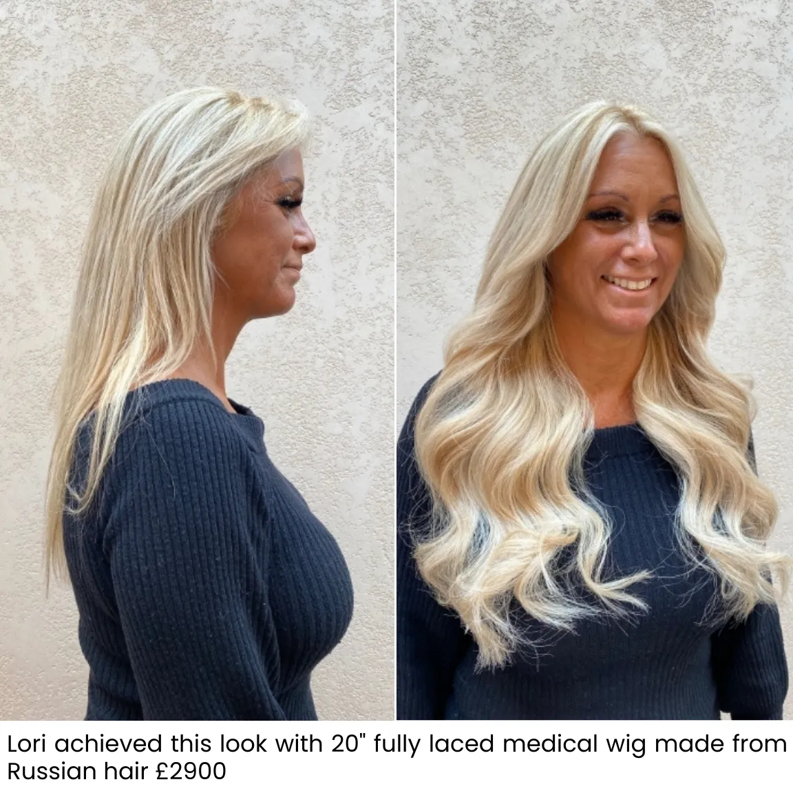 Lori, before and after medical wig